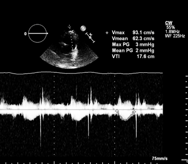 Antenatal Sonography